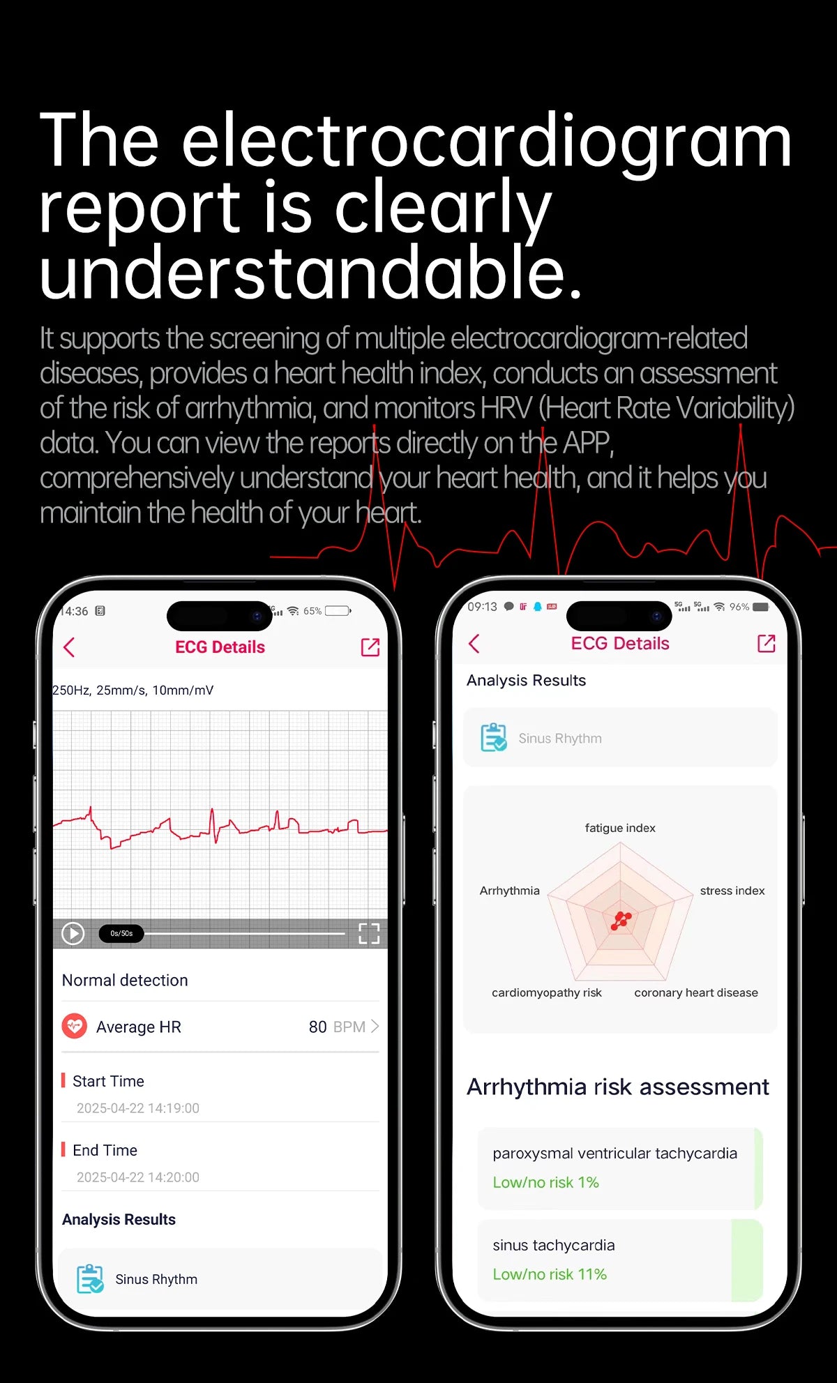 Novo relógio inteligente para Android e iOS, monitor de saúde, masculino e feminino, com precisão de ECG e PPG para ácido úrico e pressão arterial, análise de órgãos e corpo, 2025