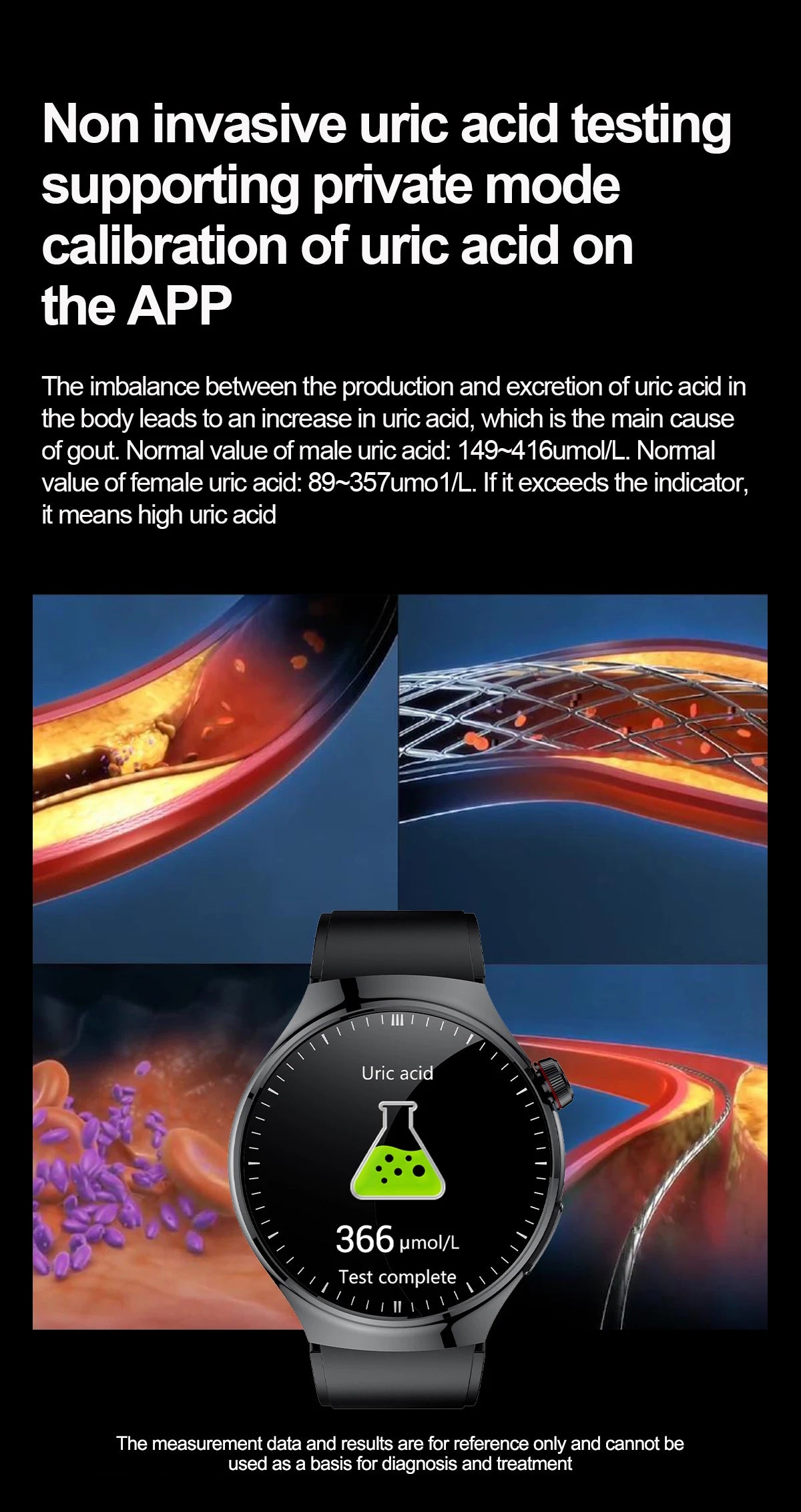 2025 para HUAWEI Precise ECG + PPG Ácido Úrico HD Smart Watch Masculino Lipídios no Sangue Frequência Cardíaca Pressão Arterial Esporte Chamada Saúde Smartwatch