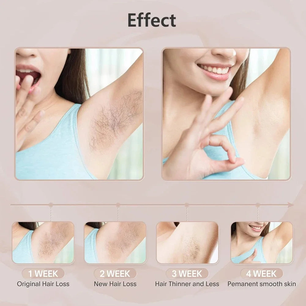 Sistema de depilação IPL para mulheres 990000 flashes Dispositivo depilador a laser permanente indolor para corpo, biquíni e removedor de pelos faciais em