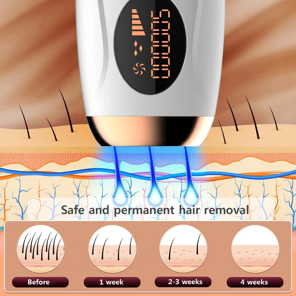 Sistema de depilação IPL para mulheres 990000 flashes Dispositivo depilador a laser permanente indolor para corpo, biquíni e removedor de pelos faciais em