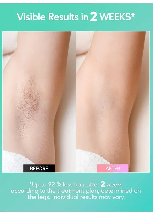 Depilador a laser 4 em 1, venda quente de depiladores permanentes IPL, fotodepiladores, depilação, máquina depiladora elétrica indolor