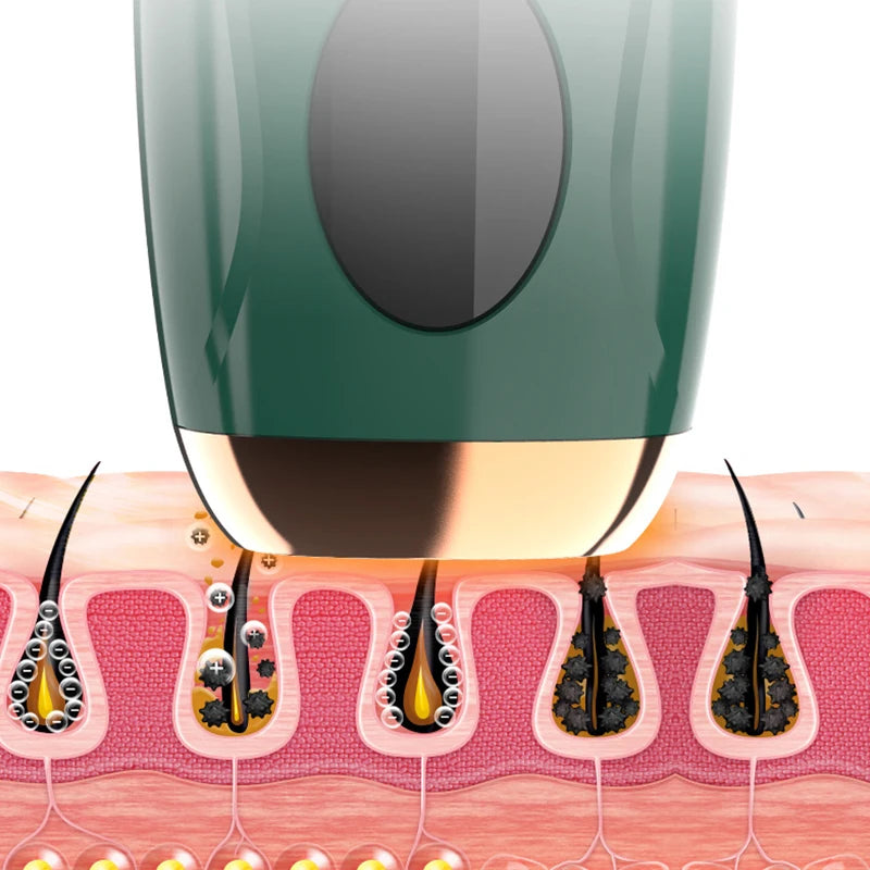 Sistema de depilação IPL para mulheres 990000 flashes Dispositivo depilador a laser permanente indolor para corpo, biquíni e removedor de pelos faciais em